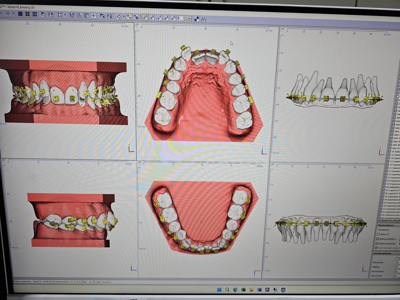 Modelul digital al arcadelor, deschis în programul de design